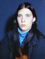 4214- Lynn McGrath scar on nose, February 12, 1972
